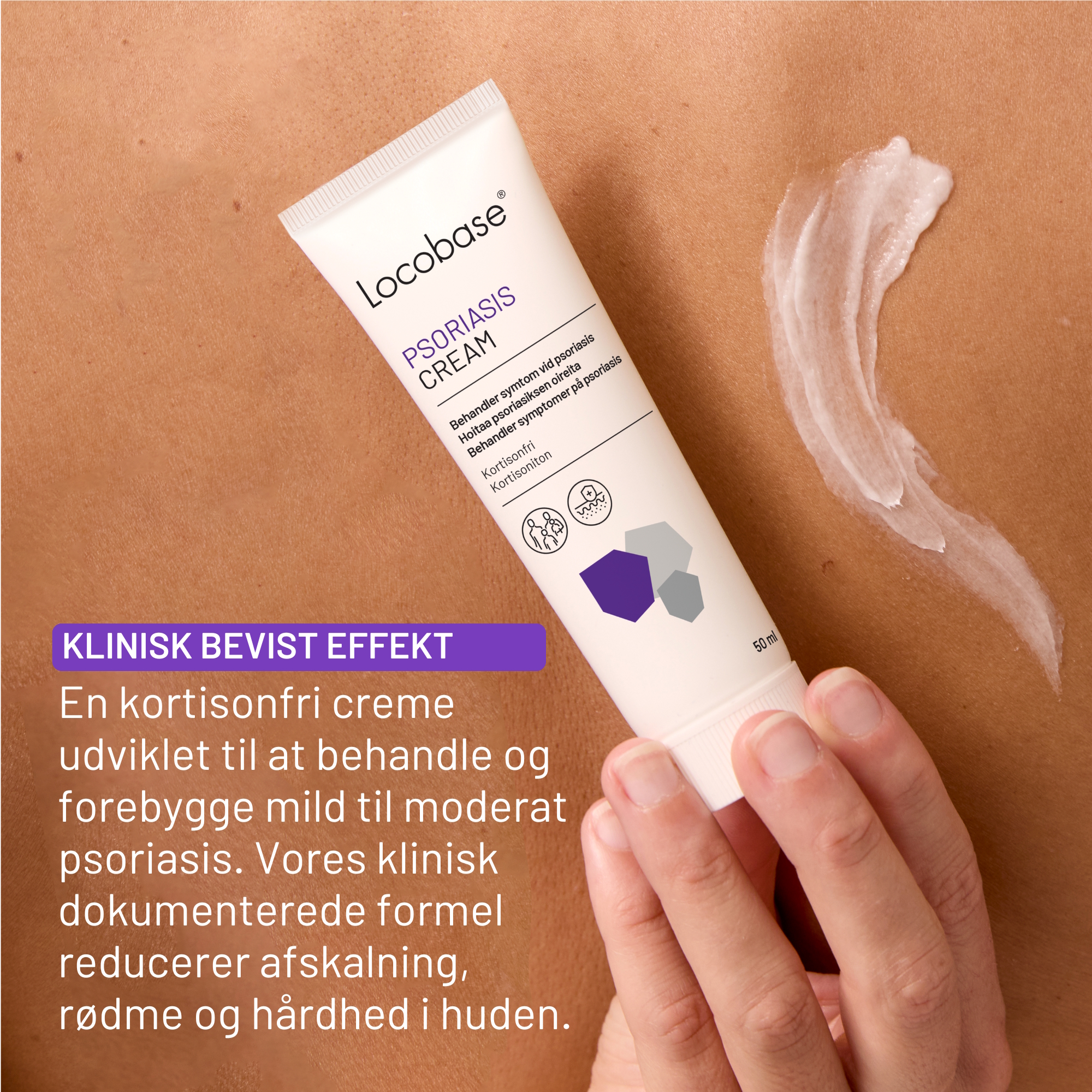 Locobase Psoriasis Cream