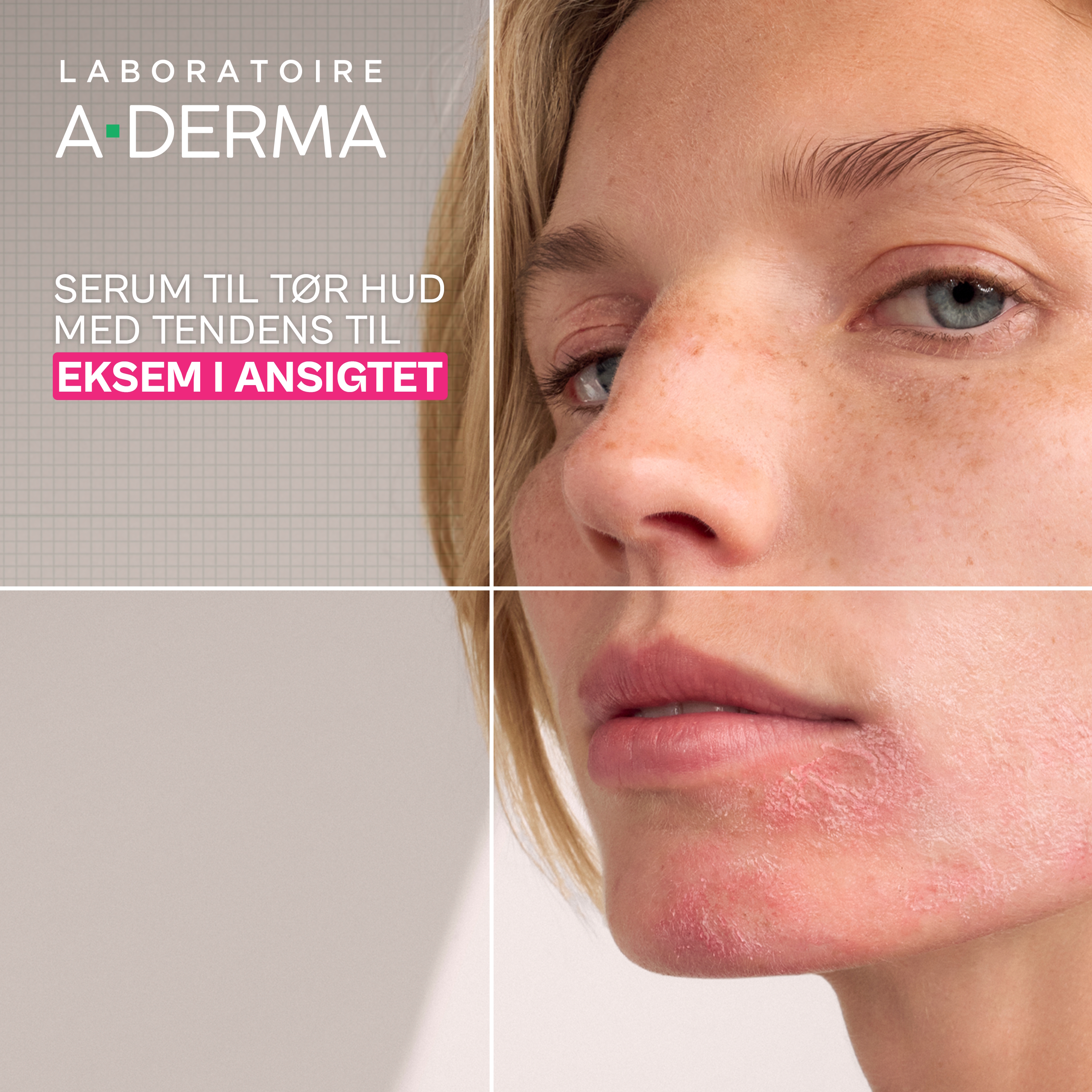 A-DERMA EXOMEGA Ultra-Calming Serum